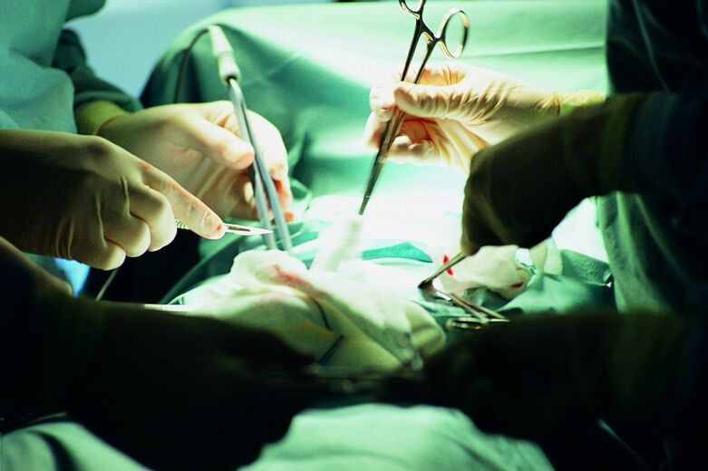 creșterea chirurgicală a grosimii penisului